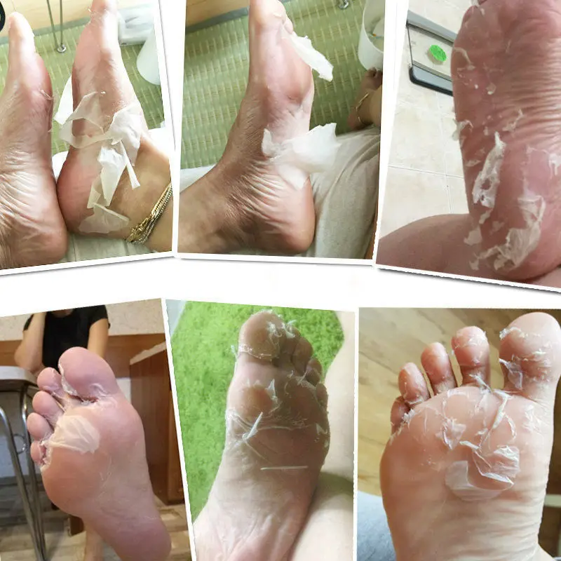 Aliver алоэ Отшелушивание ног маска носки детские мягкие для удаления