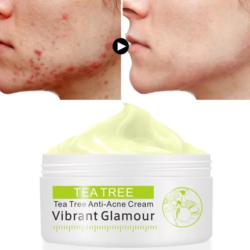 30 г/кор. устраняет Acnes крем контроль масла ремонт пятнистого дерева анти-акне крем акне лицо со шрамом крем для уменьшения пор лица