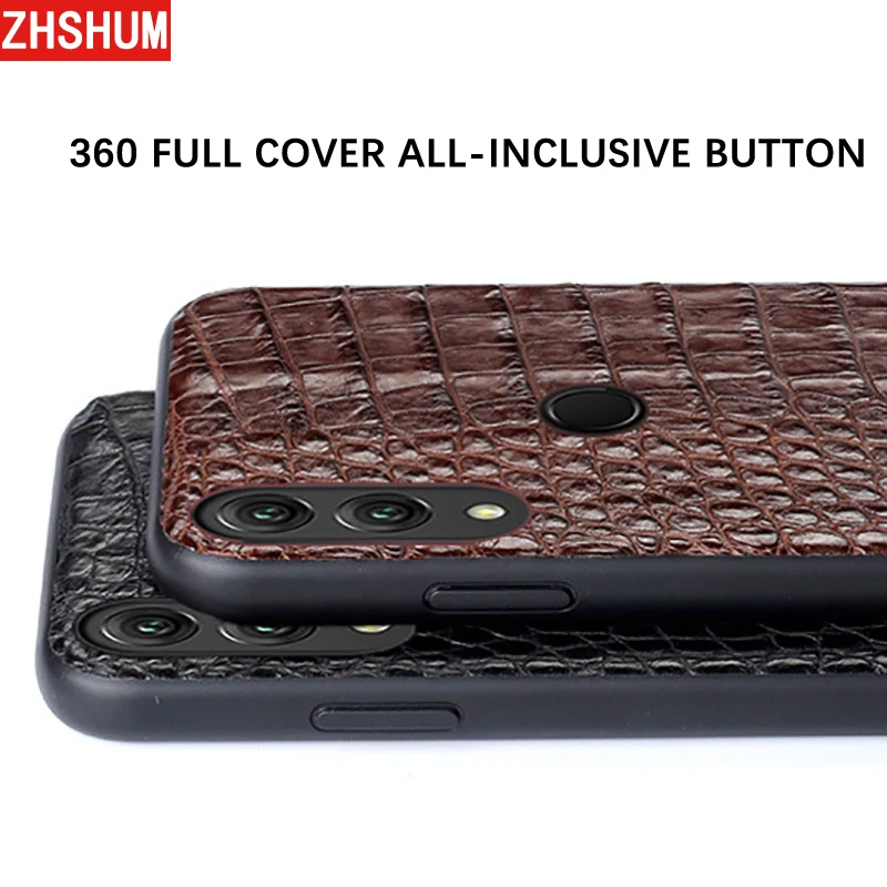Genuine Crocodile Leather Case For Huawei P20 Lite Note 10 Luxury Handmade Skin Full Back Cover for Honor Note10 Xiaomi 8 |