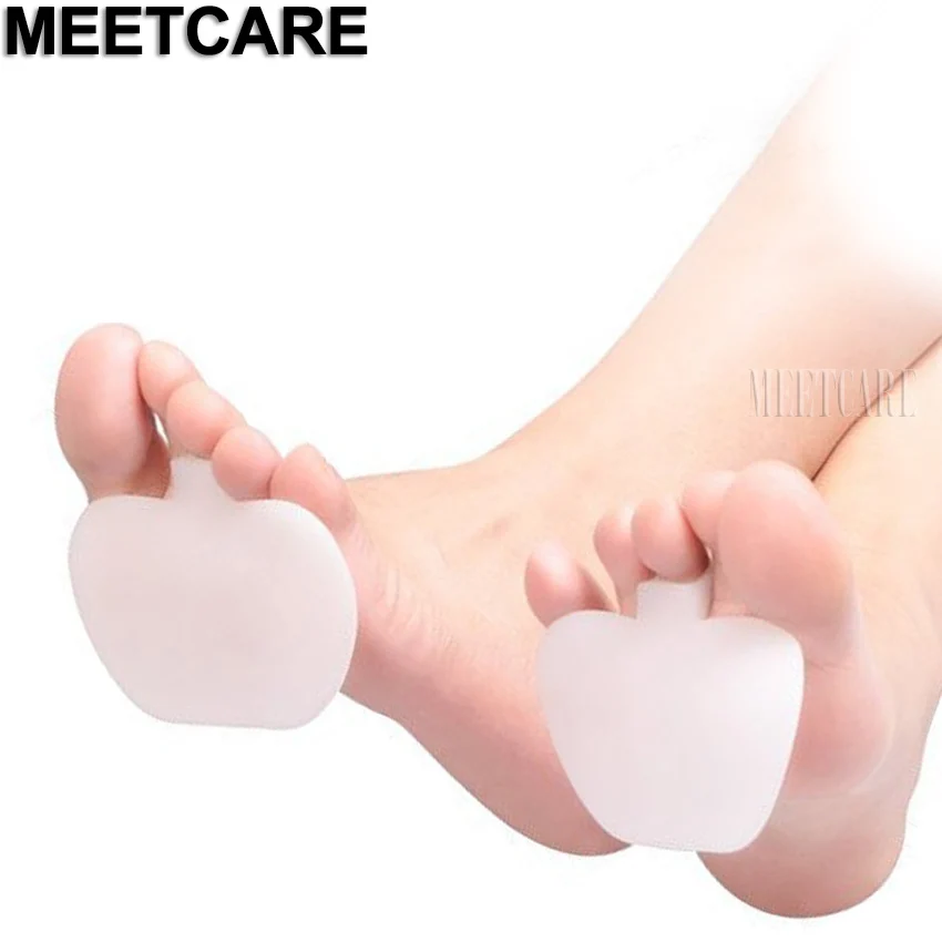 Фиксатор для обуви на высоком каблуке в форме яблока или груши|shoe brace|foot braceshoes for