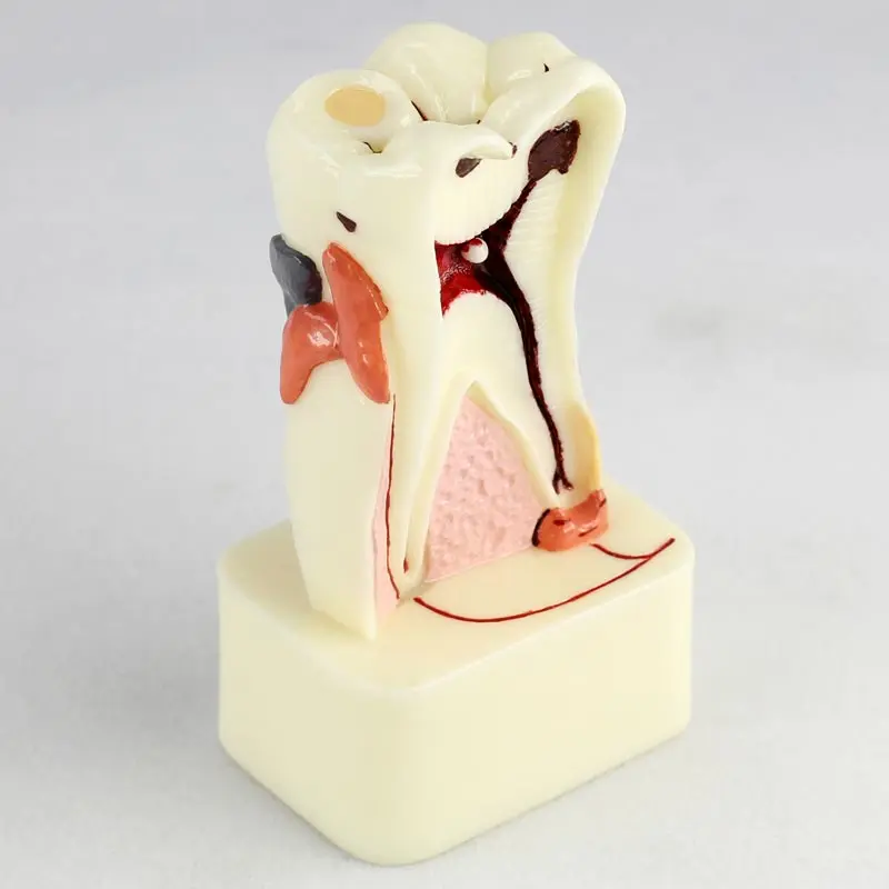 Модель скелета для лечения зубов 4 размера|model skeleton|model skeleton for salehuman anatomical |