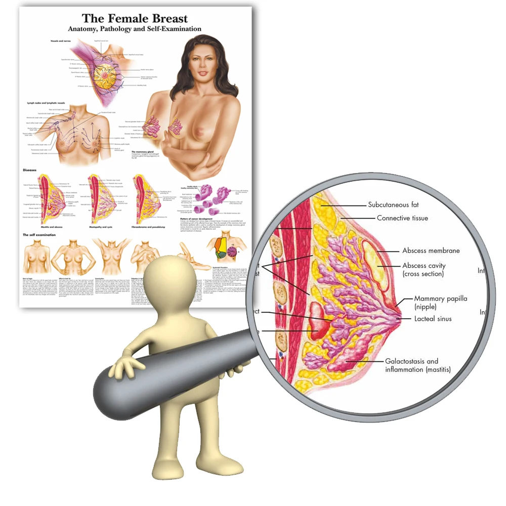 

WANGART Female Breast Chart Anatomy Pathology Self Examinatio Canvas Print Wall Pictures for Medical Education Office Home Decor