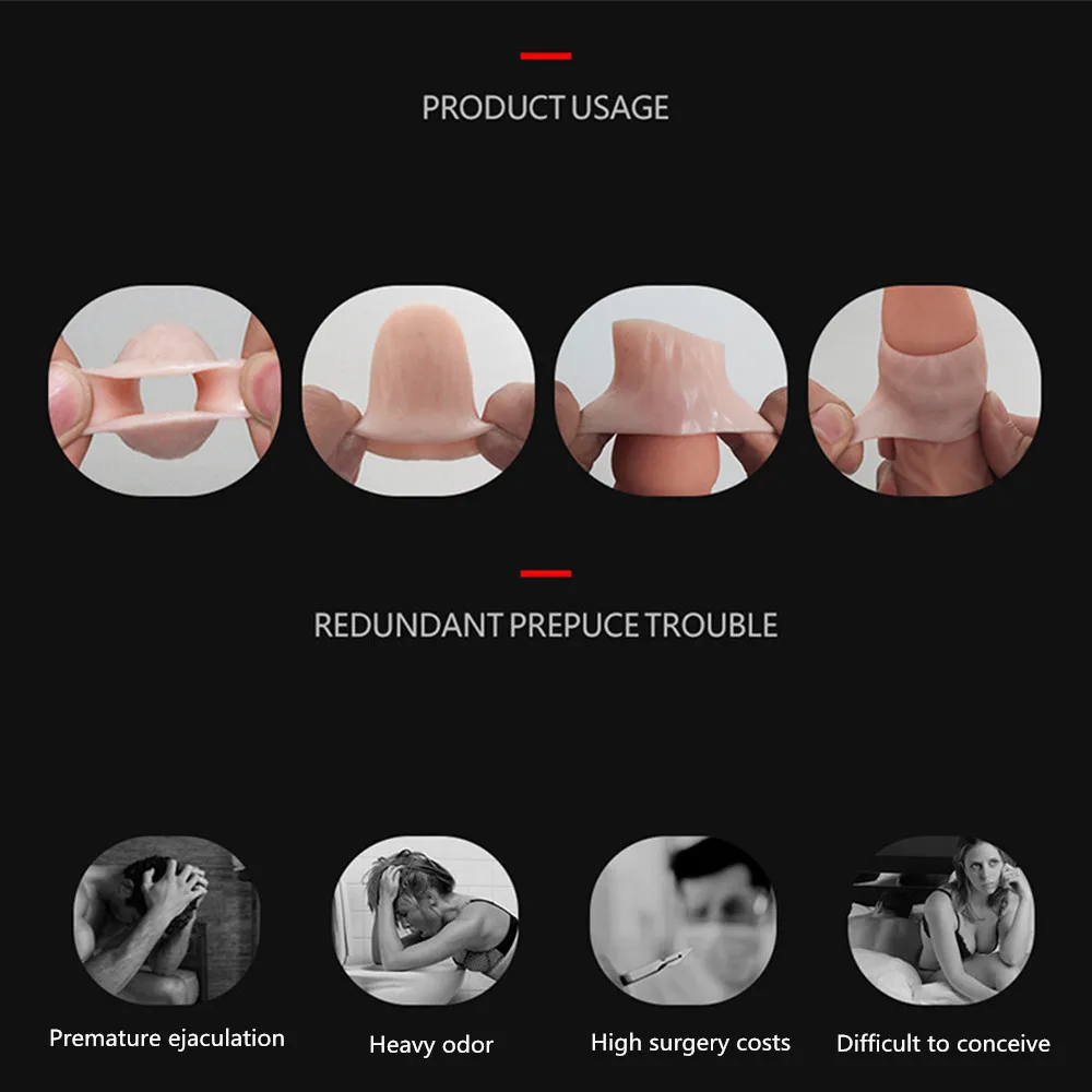 Мужское кольцо для пениса из ТПЭ выпрямитель Foreskin рукав тараканов коррекция