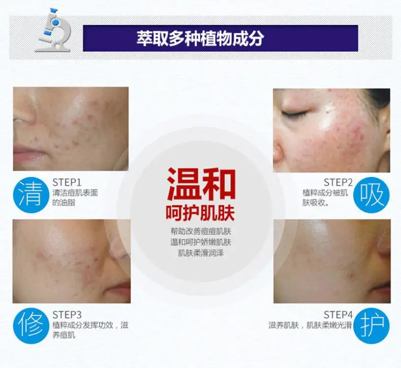 Крем для ухода за кожей лица BIOAQUA мужчин и женщин эффективный крем удаления акне