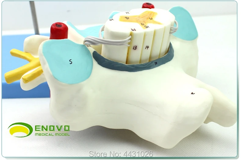 

ENOVO The anatomical model of the nerve orthopedics of the cervical spinal cord and spinal nerve