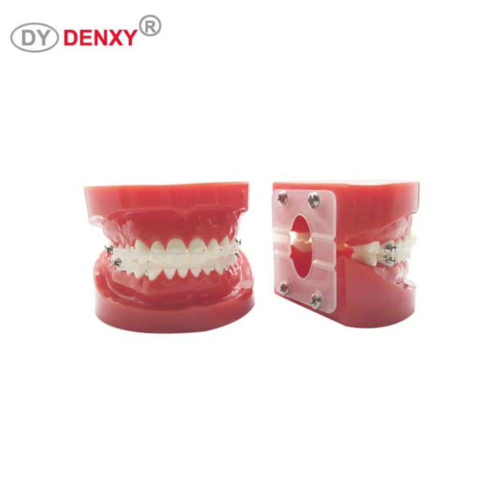 Denxy 1 шт. Стоматологическая модель с Ортодонтическая скобка исследование зубов Модель инструкция зубной ортодонтический керамический брекет Стоматологическая скоба