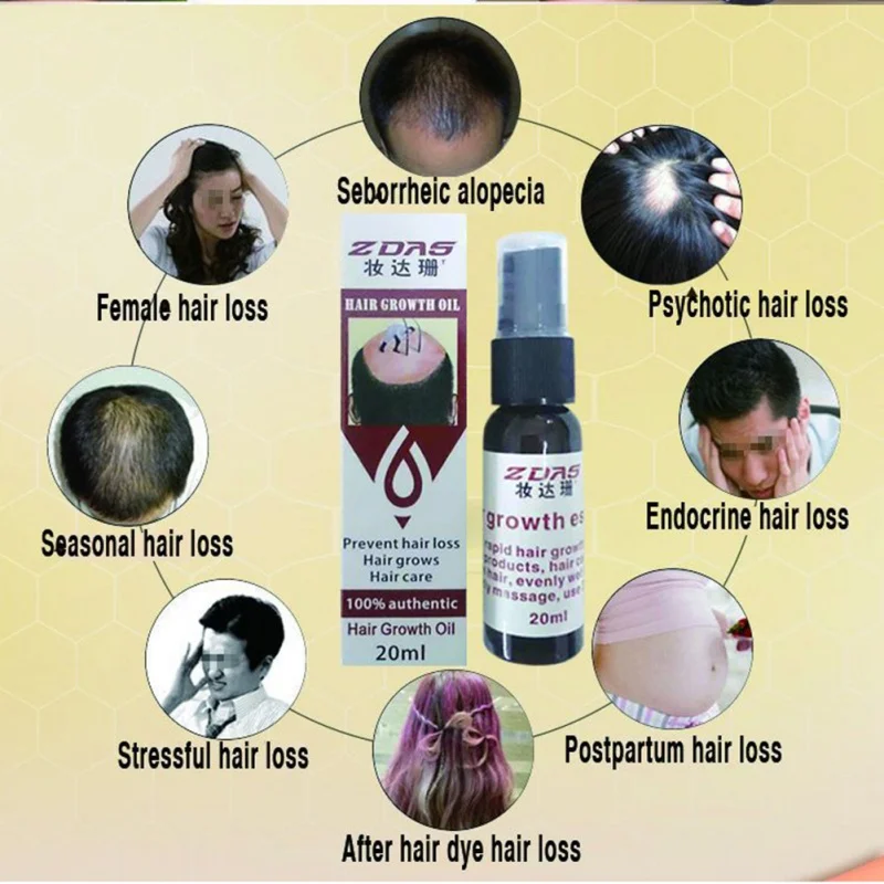 100% аутентичный продукт для выпадения волос утолщенный спрей роста женщин и