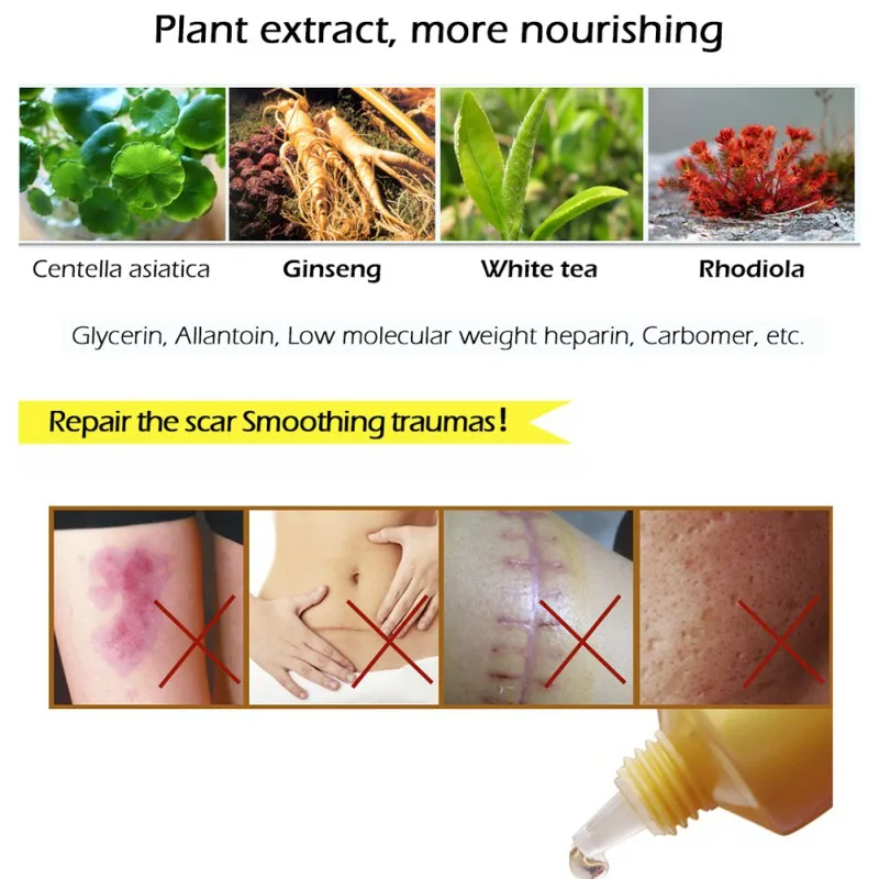 

Face Beauty Scar Removal Cream Skin Repair 30ml Face Cream Blemish Spots Treatment Blackhead Whitening Cream