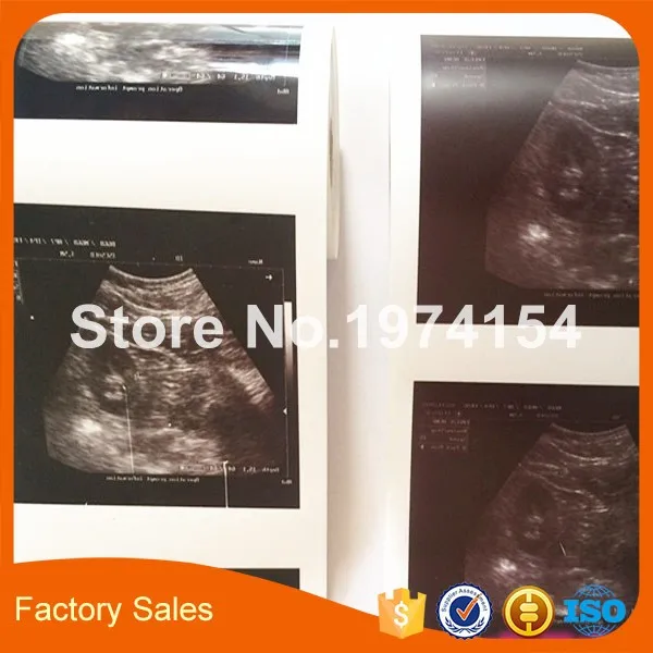 2X Rolls ultrasound UPP 110S 110mm*20m B-recorder UPP-110S thermal paper printer b-sheets A6 | Компьютеры и офис