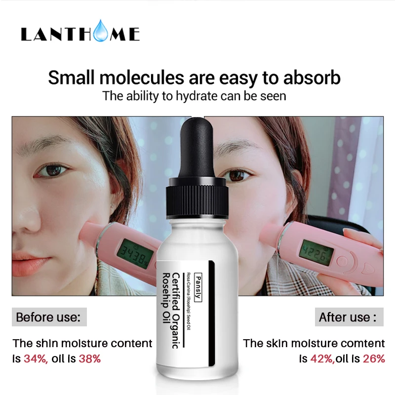 2 шт. антивозрастной органический чистый масло шиповника анти шрамы тонкие