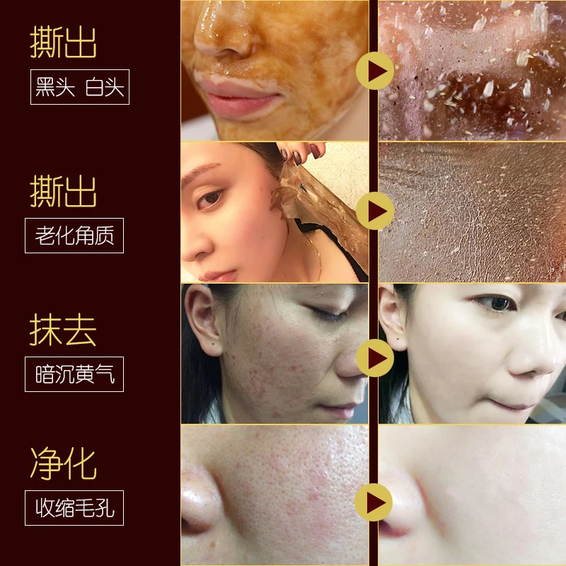 LAMILEE honey маска для удаления черных точек пилинг контроль масла безболезненный