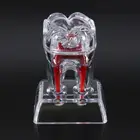 Молярная Модель зубов с большим зубом, демонстрационная модель для обучения, прозрачный материал для стоматологии, модель зубов в стоматологической лаборатории