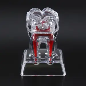 Молярная Модель зубов с большим зубом, демонстрационная модель для обучения, прозрачный материал для стоматологии, модель зубов в стоматологической лаборатории