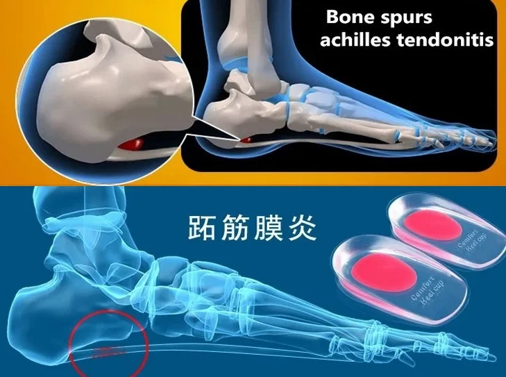 Силиконовые стельки для ухода за пяткой забота о пятке предотвращение шпоры