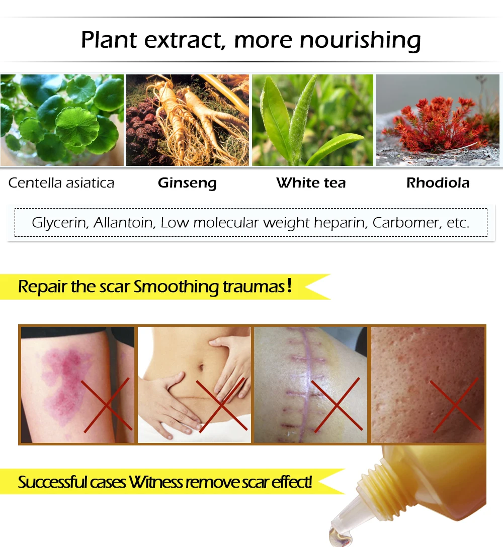 Крем для удаления шрамов от акне LANBENA отбеливающий крем лица пятен и угрей 30