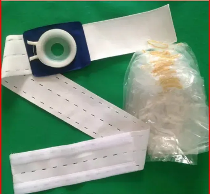 with 160 pcs bags Высококачественная медицинская 8 см широкая резиновая повязка ремень с 160 шт остомой мешок одноразовый искусственный анальный мешок Силиконовое кольцо можно отрезать - Цвет: with 160 pcs bags