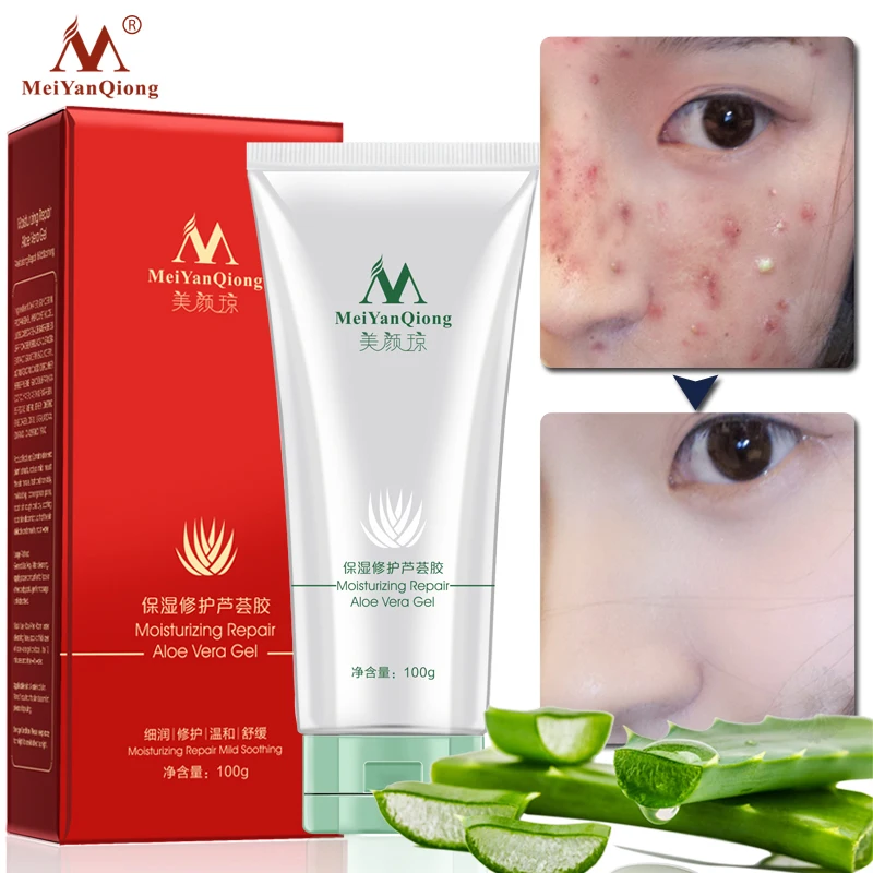 

MEIYANQIONG Moisturizing Repair Aloe Vera Gel Skin Care Natural Plant Extract Acne Treatment Gentle Soothing Facial