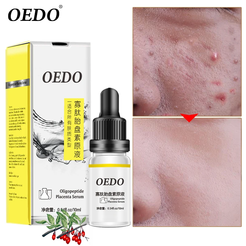 Средство для ухода за кожей лица против морщин|Сыворотка| |