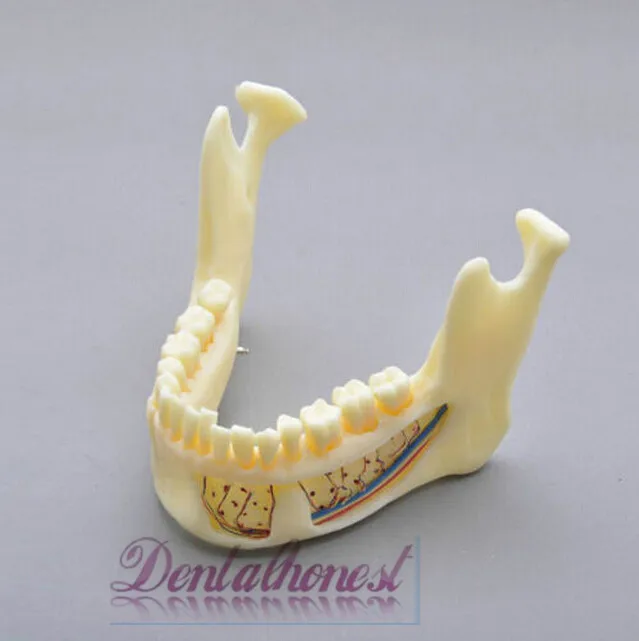Dentalmall Стоматологическая модель #5004 02 Съемная профессиональная