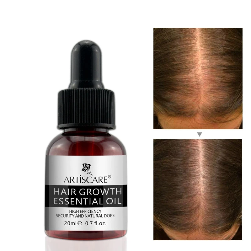 

Faster Thicken Hair Growth Hair Growth Essential Oil Hairs Loss Treatment For Women Men New