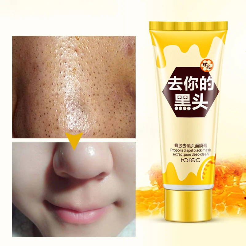 ROREC средство для удаления черных точек лица и маска носа очищающая пористую