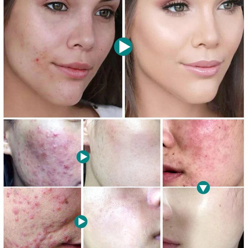 Крем для лица с эффектом увлажнения и отбеливания | Красота здоровье