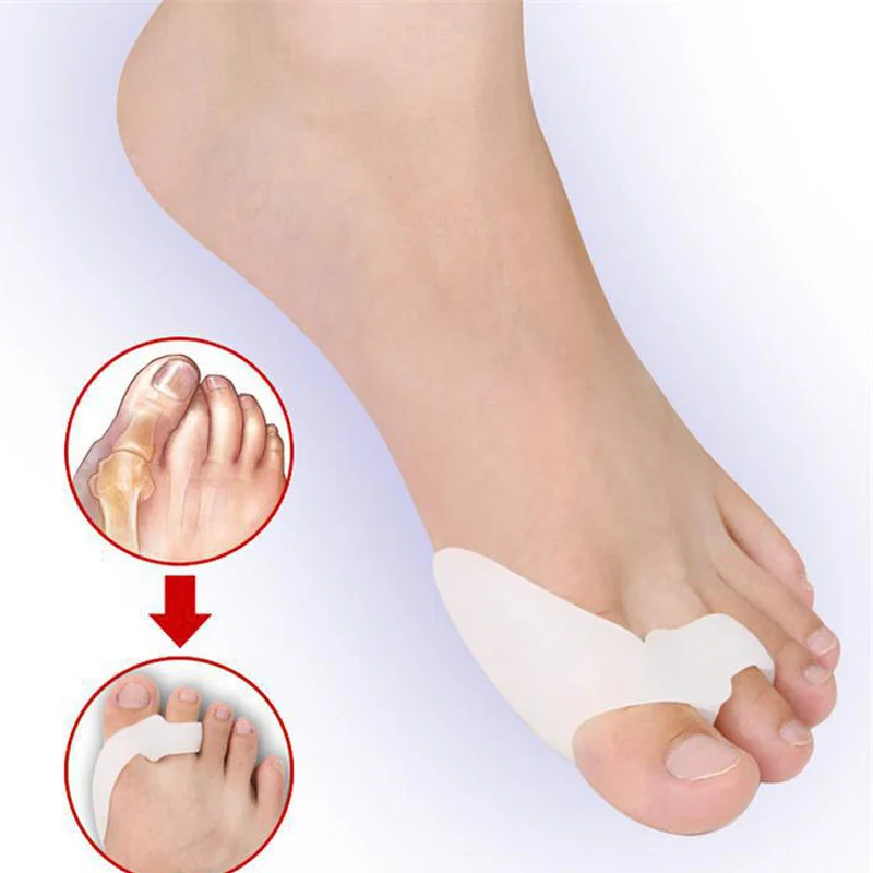 2 шт. силиконовый разделитель для большого пальца Сепаратор ортопедические