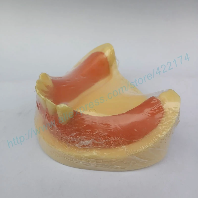 Бесплатная доставка модель для тренировки имплантации зубных зубов с деснами