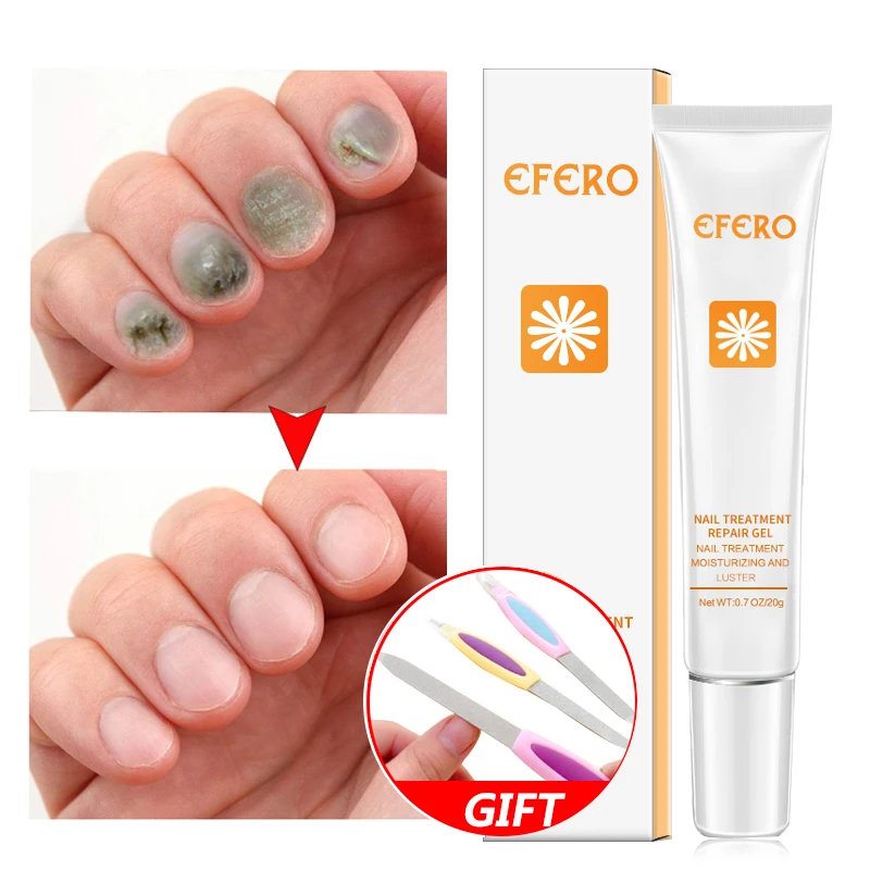 EFERO Nail Repair Essence Serum Toe Nail Fungus Onychomycosis Removal Treatment Nail Care Essence Anti Fungal Nails Repair Cream