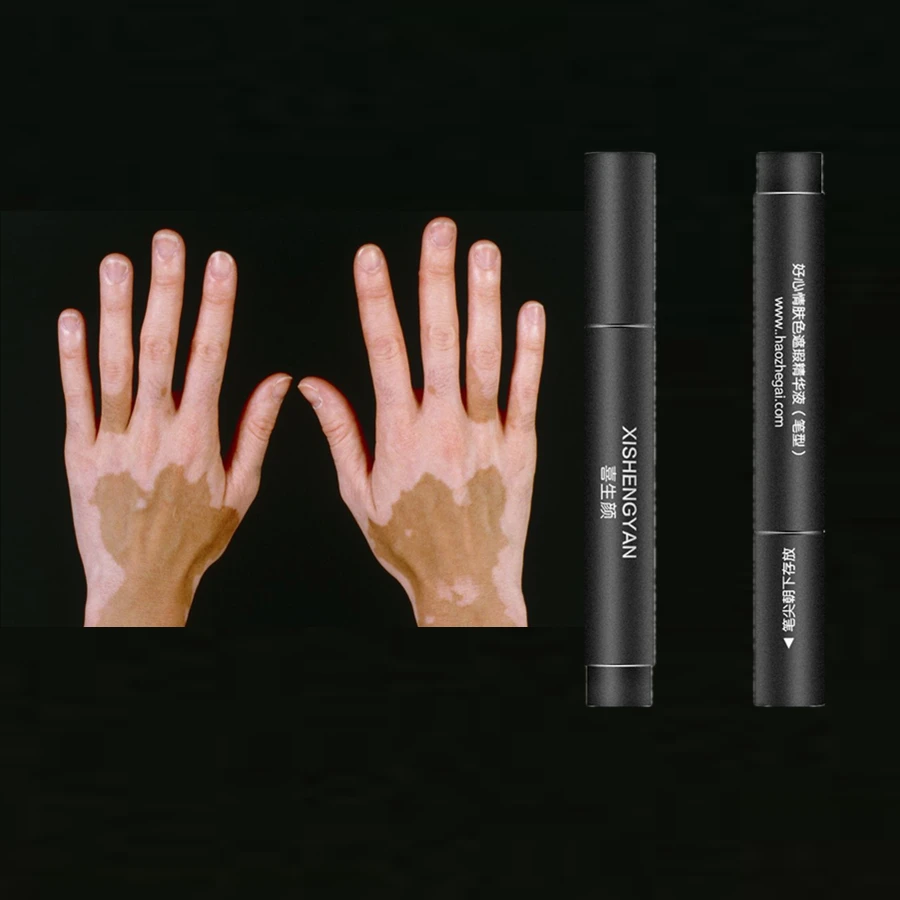 Витилиго Nесь Укрыватель Покрывающая ручка Водонепроницаемая Длительная скрыть