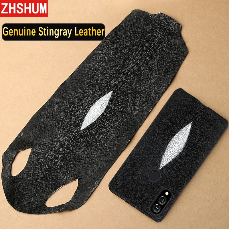Genuine Stingray Skin Case For Huawei P20 Lite Luxury Leather Handmade Customize Full Back Cover for Honor Note 10 Note10 |