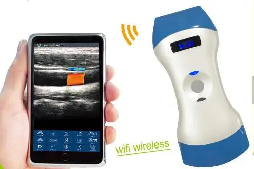 Portable wireless Probe bladder Ultrasound Scanner