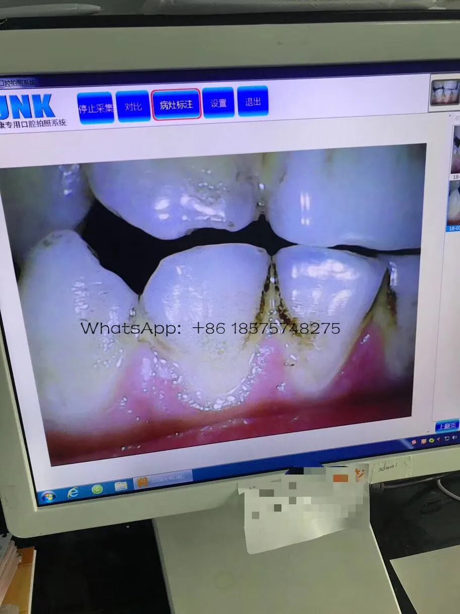 Стоматологическая Камера с монитором плотно прилегающие к уху супер чистый