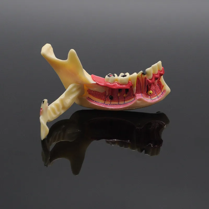 

Dental Communication Model Mandibular Model for Dental Teaching Training Model