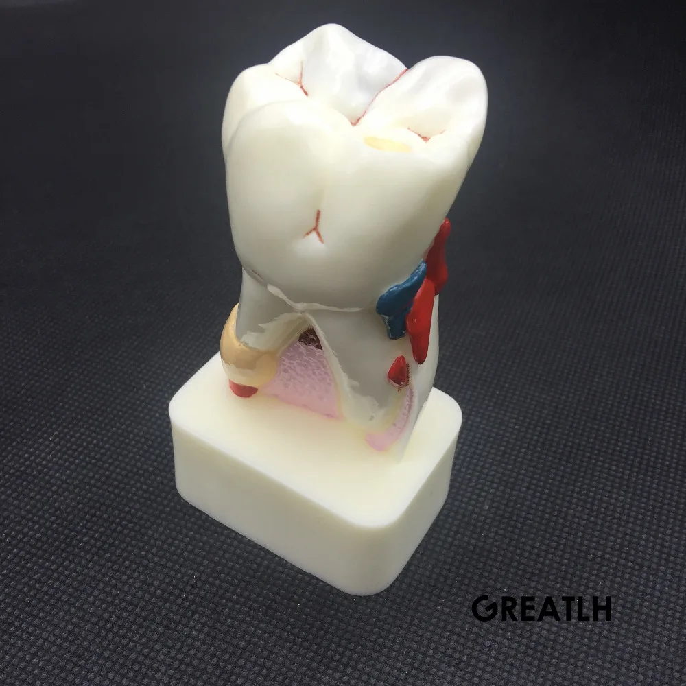 Лучший стоматологический стоматолог обучающая модель зубов новинка|dental tooth|model