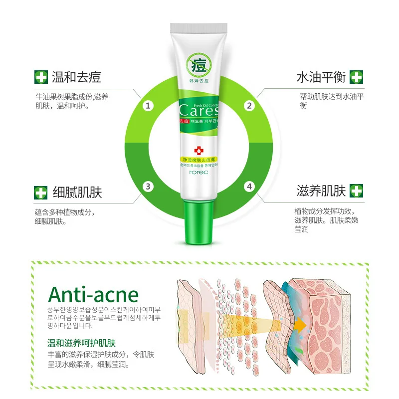 ROREC крем для акне уход за кожей удаление ремонт очищающий Comedone прыщи быстро лица