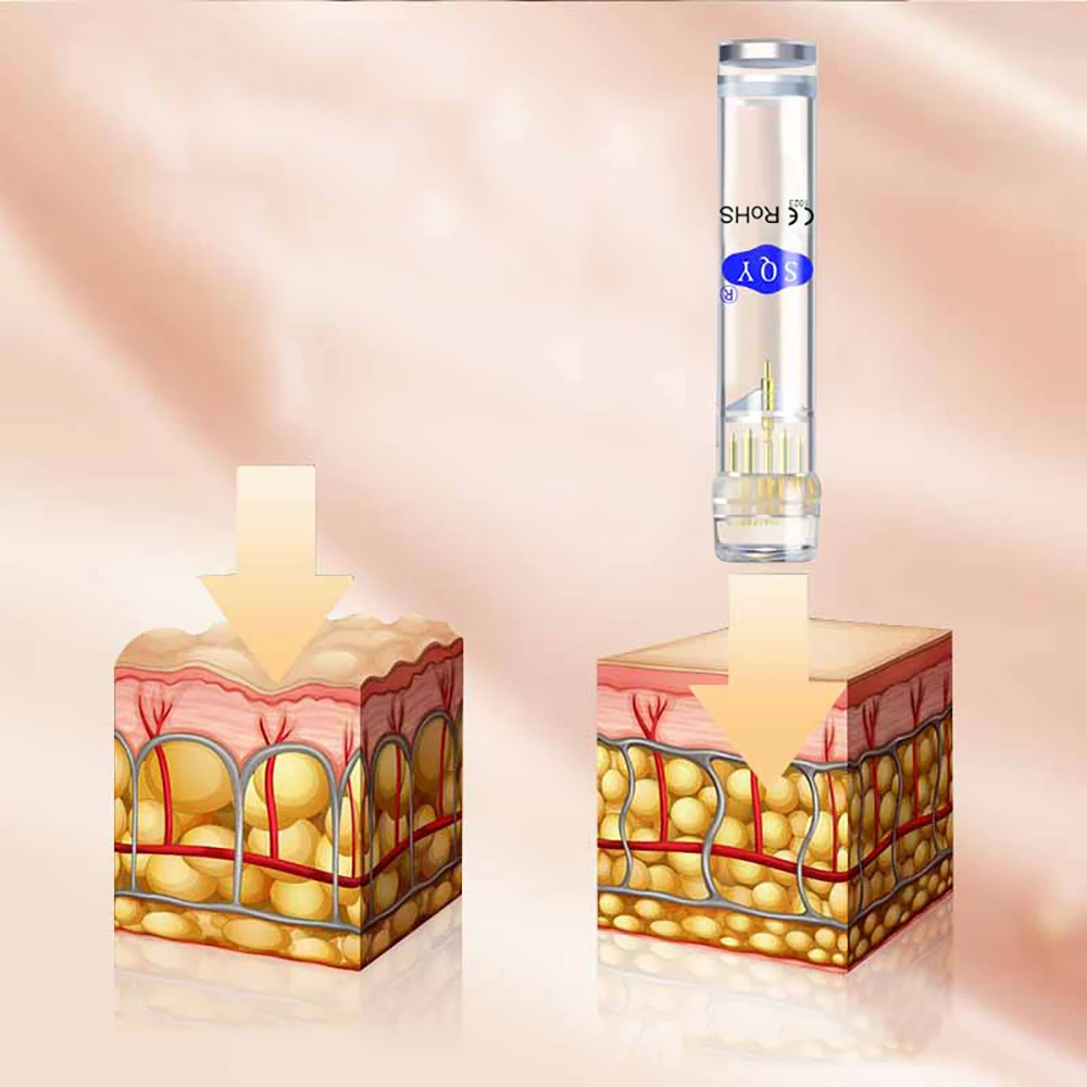 Дерма ролик иглы титановая Золотая Derma Штамп для женщин красоты уход за кожей