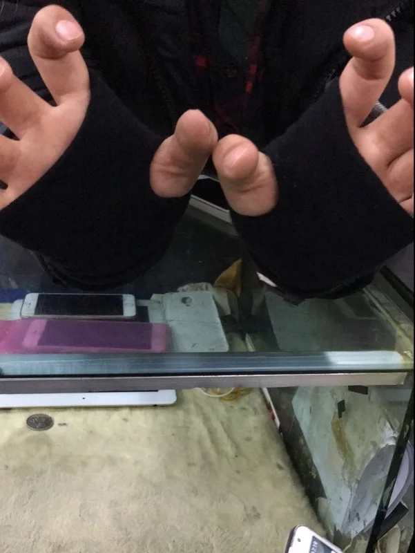 thumb