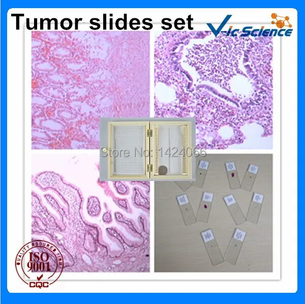 Microscope tumor prepared slides set