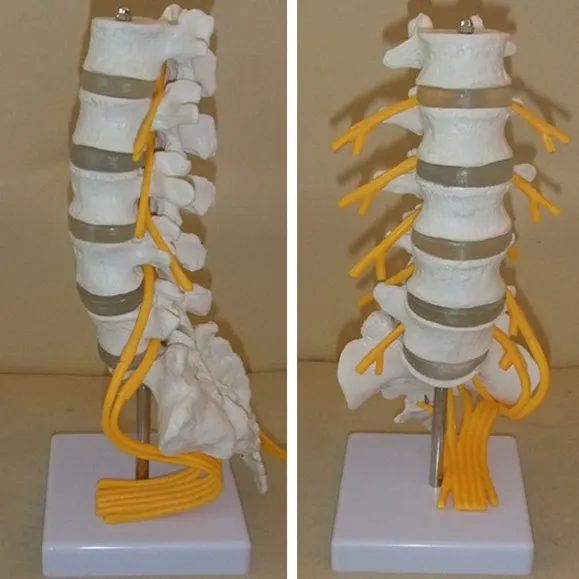 Spine 505 модель