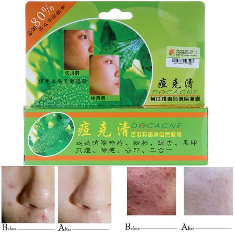 Крем для лица 30 г ухода за кожей акне дезальт отпечаток крем подходит проблем с |