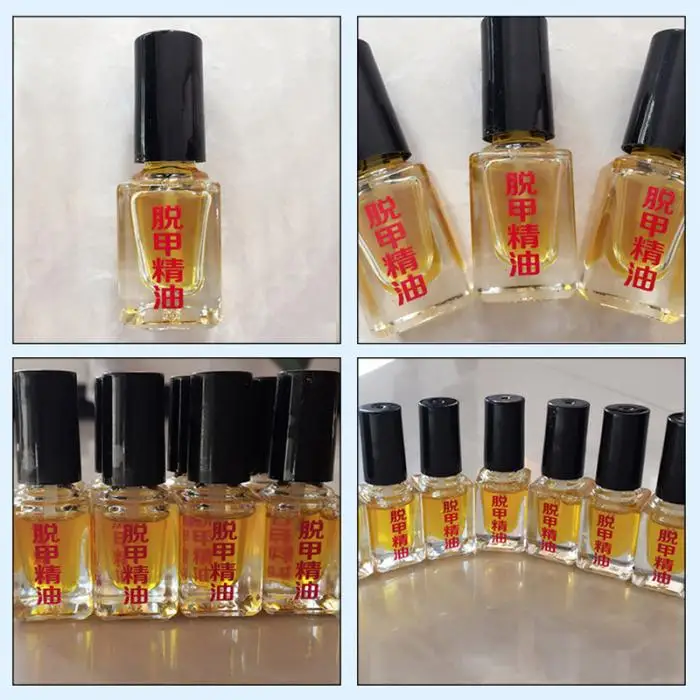 Лечение ногтей Удаление онихомикоза паронихия против жира бактерицидная