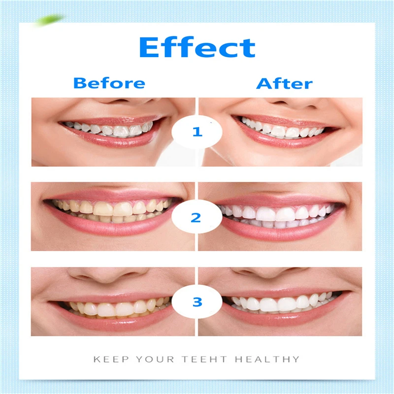 

1Pcs Hot Creative Effective Teeth Whitening Pen Tooth Gel Whitener Bleach Stain Eraser Sexy Celebrity Bright Smile Teeth Care