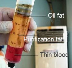 Популярная машина для трансплантации жира с липосакцией стволовых клеток