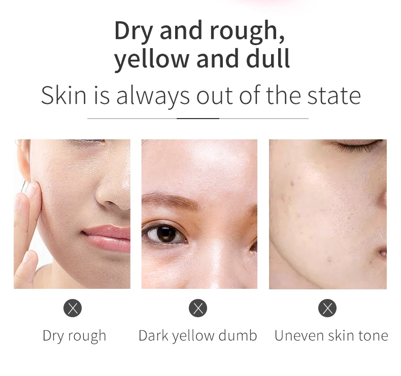 Fonce Plant extracts Toner 80ml Silk collagen 24K gold Lavender essence rose essential oil Whitening Brighten Oil Acne Control