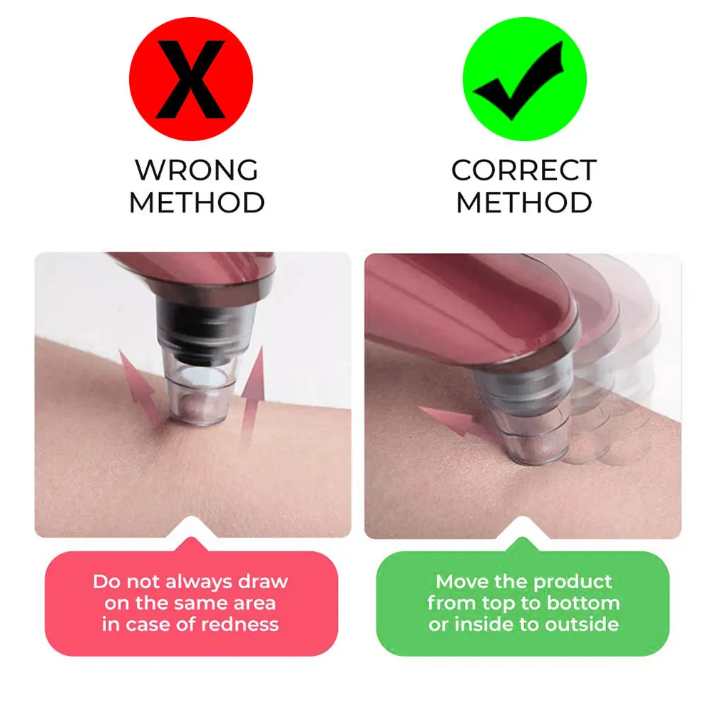 Пылесос для удаления черных точек уход за кожей лица очищающая машина акне