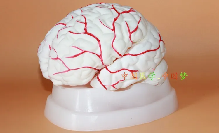 

1:1brain Anatomical Model Intraventricular Brainstem Cerebrovascular free shipping