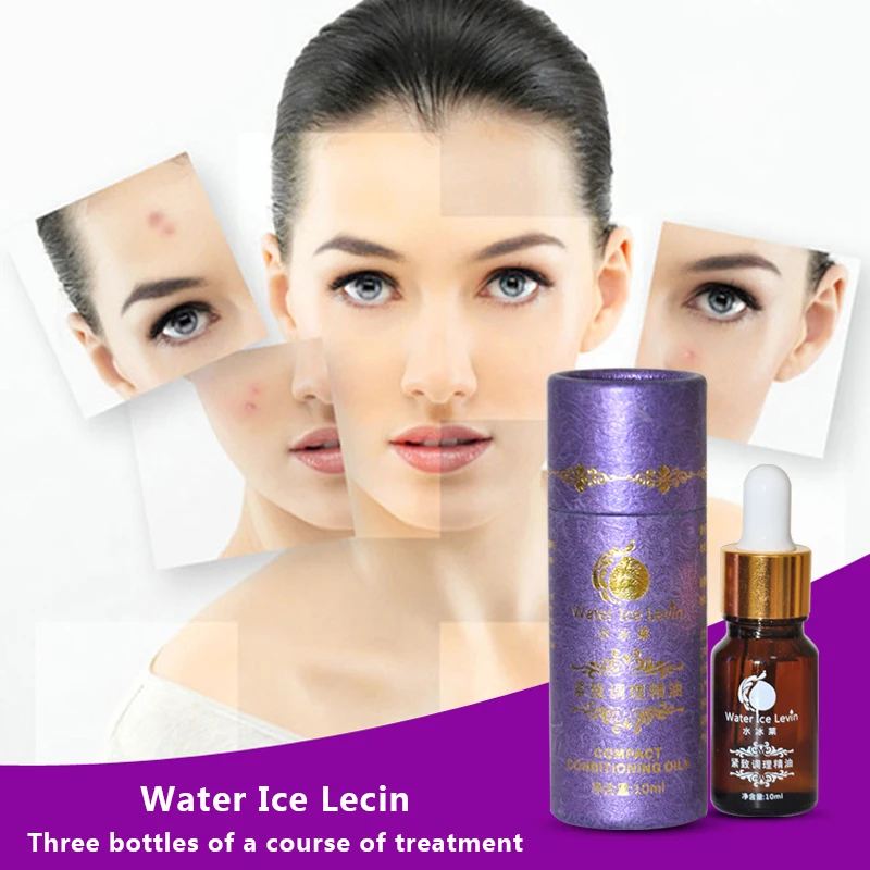 Марка здоровье Уход за кожей лечение акне Акар Remover мощным лаванды Эфирные масла