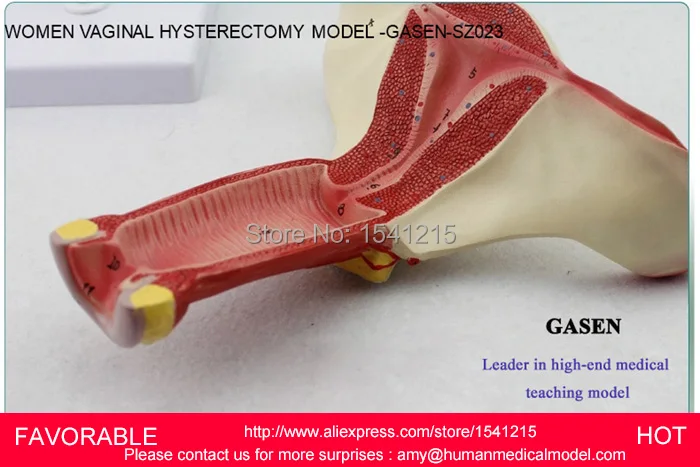 Модель матки модель генитальной анатомии учебная медицинская планирования