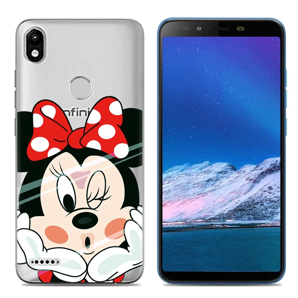 for Infinix Smart 2 X5515 5.45inch Case Silicone Back Cover Smart2 Phone Shell TPU Soft fundas |